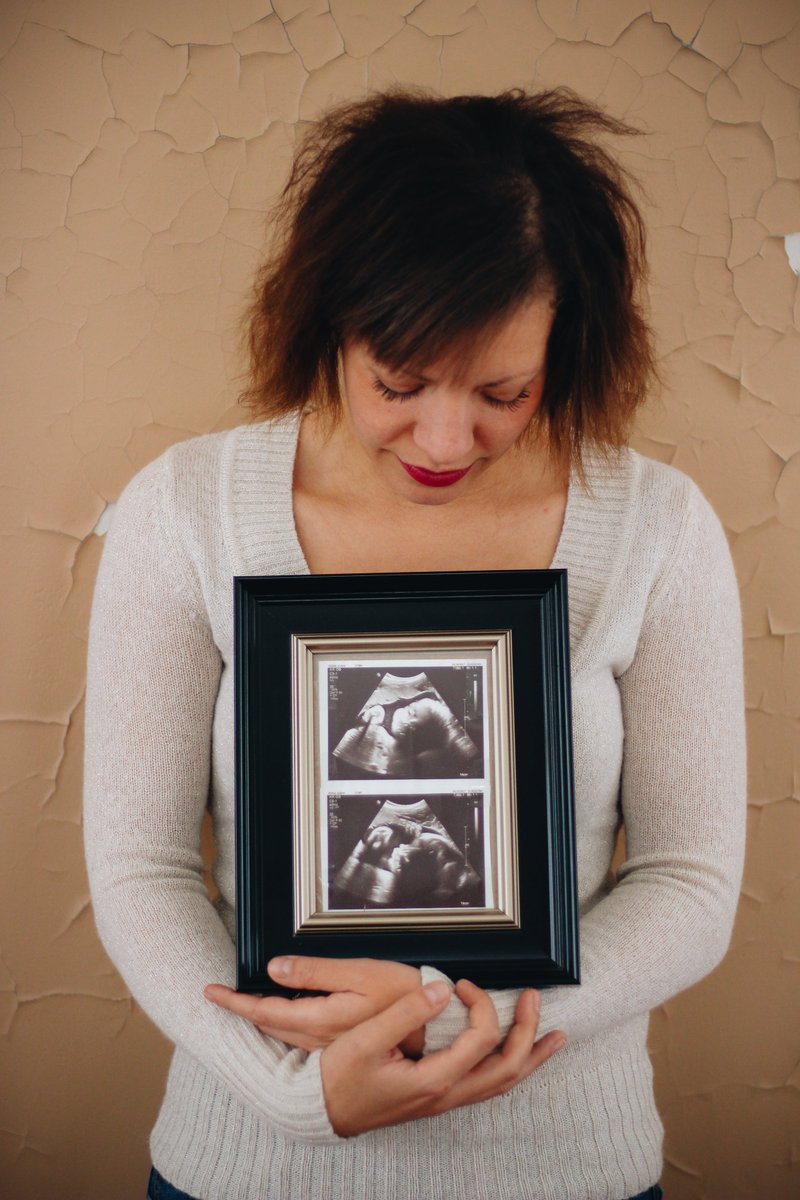 soproudofwhoiam's tweet photo. August, you are 9 months old today. You were named after a great man, because I know that this is what you are destined to be. I love you sweetie. Happy 9 months my Son 💚#supportfamilypreservation #unecissaryadoption #hiddenabuseawareness #stopabuseinadoption #beingadoptedmeans https://t.co/KEvB6VvJfo