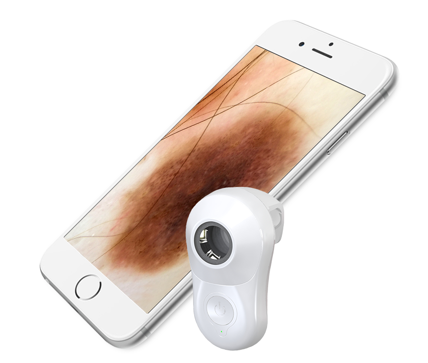 MetaOptima's tweet photo. Intelligent Dermatoscopy Tools. Polarized lighting and contact/non-contact imaging to suit your clinic’s needs. Read more https://t.co/ZTTpIbSDjL about MoleScope II vs. other dermoscopes.
#Dermatoscopy #dermoscope #dermatology #dermatologist #healthtech #AI #skincancer https://t.co/IYy5ff6LxX
