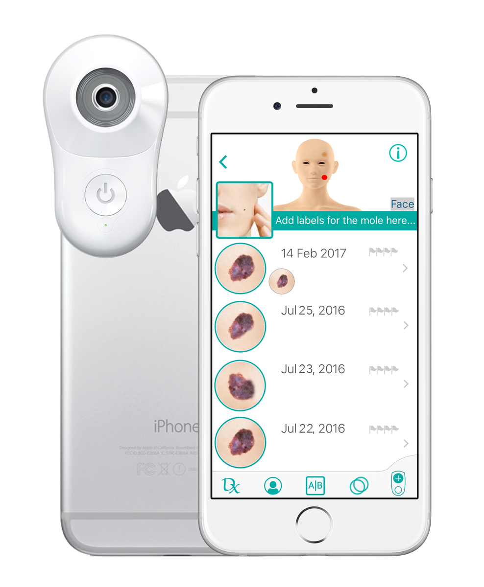 MetaOptima's tweet photo. Intelligent Dermatoscopy Tools. Polarized lighting and contact/non-contact imaging to suit your clinic’s needs. Read more https://t.co/ZTTpIbSDjL about MoleScope II vs. other dermoscopes.
#Dermatoscopy #dermoscope #dermatology #dermatologist #healthtech #AI #skincancer https://t.co/IYy5ff6LxX
