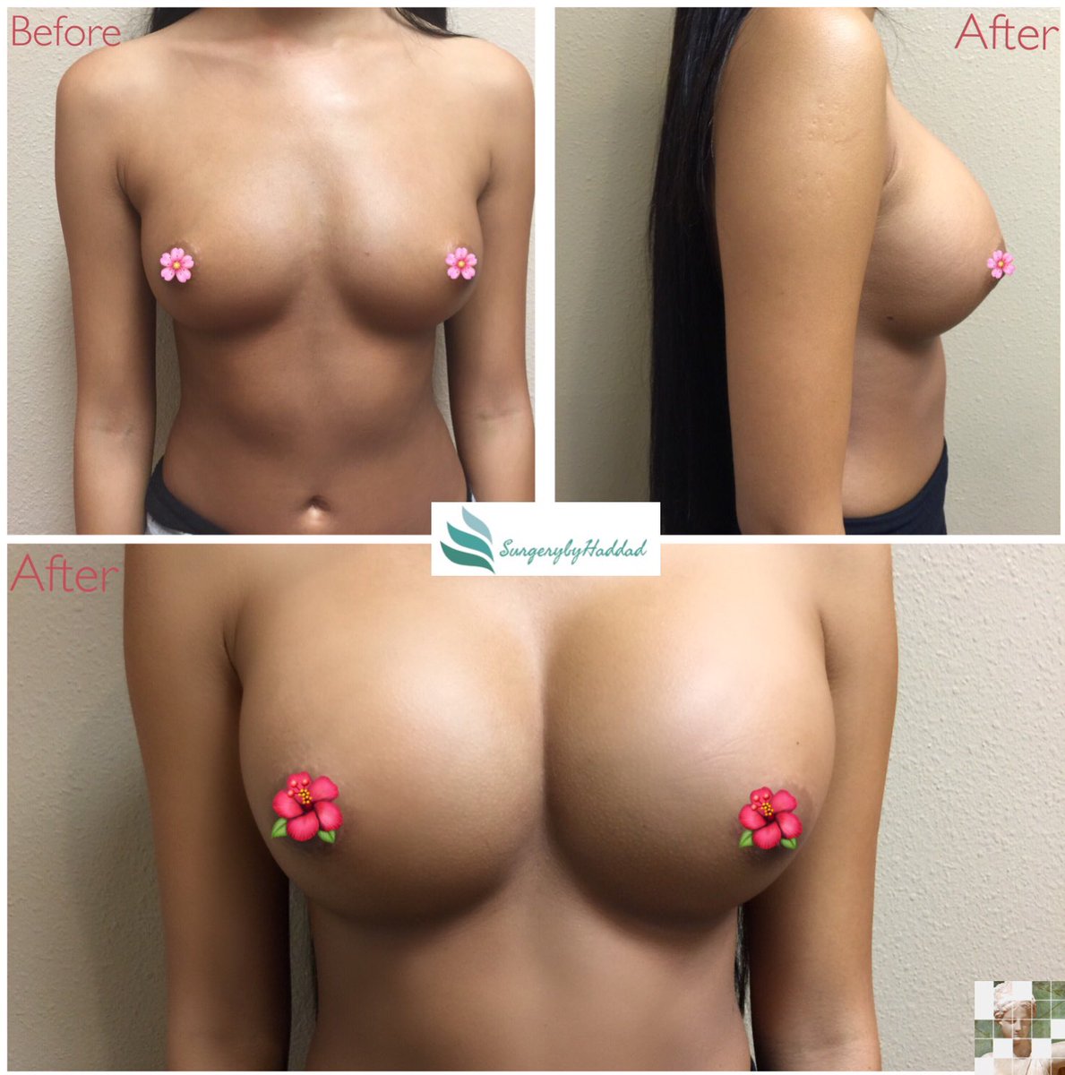 Nazih M. Haddad M.D. tweet media