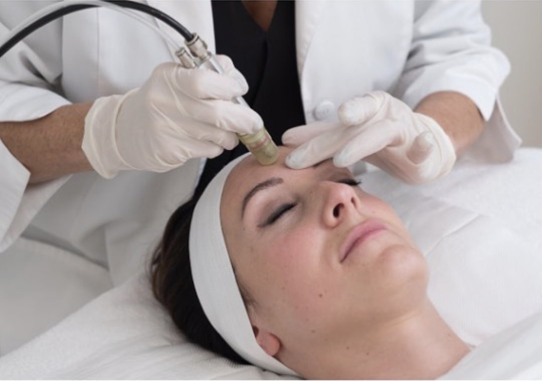 UnionDerm's tweet image. We are excited to announce our partnership with Rhea Souhleris Grous to launch La Suite Skincare at Union Square Laser Dermatology. La Suite believes in a “face-time” approach where the medical aestheticians customize advanced treatments. unionderm.com/patient-portal…