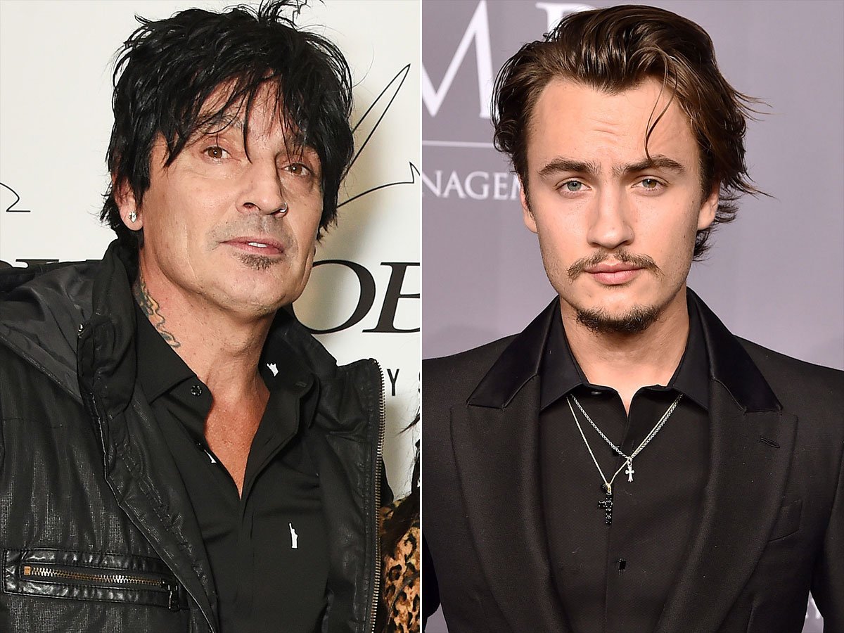 Radioacktiva_'s tweet photo. Tommy Lee, el exbaterista de @MotleyCrue, compartió una foto de su rostro ensangrentado en la que denunció que fue golpeado por su hijo Brandon Lee, de 21 años. #TheRockShowDeViernes 😎 https://t.co/zPWMjrUJVk