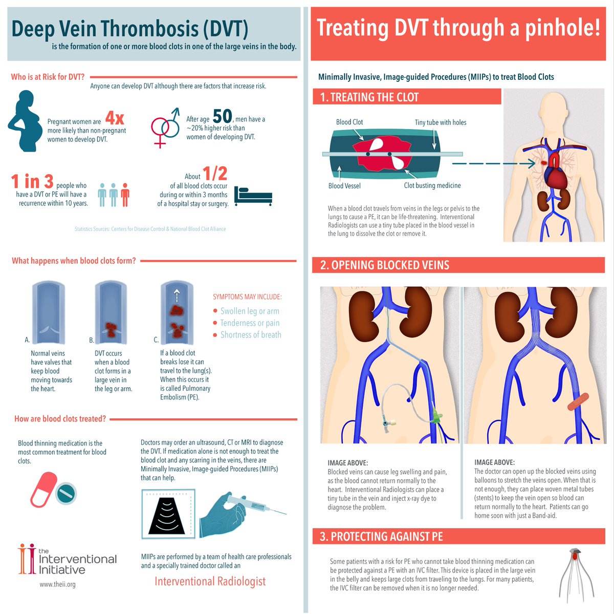 Check out the latest #Infographic on Minimally Invasive, Image-guided Procedures #MIIPs to treat #DVT #withoutascalpel 

#DVTAwarenessMonth 
#IRAD
#FridayFeeling 
#patientchat