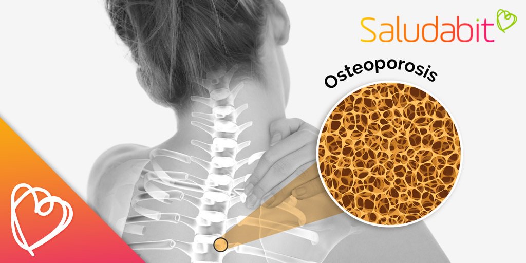 saludabit's tweet photo. Cómo fortalecer los huesos y prevenir la #Osteoporosis https://t.co/6YKHkQWktz https://t.co/7WXbD1Qn7S