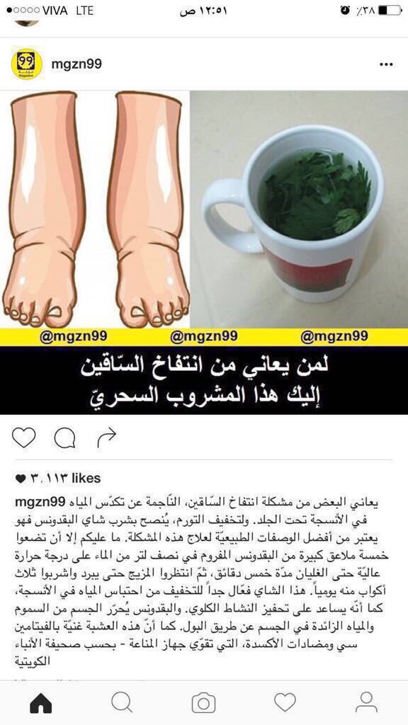 AAAAAABBBBBi's tweet photo. علاج انتفاخ السّاقين https://t.co/onBAyOLqw9