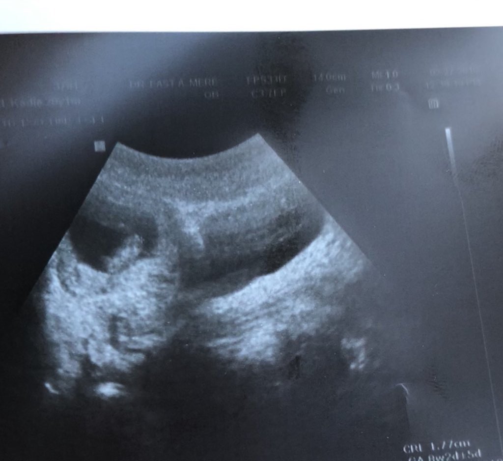 Grant__Lynch's tweet photo. See you in October 👶🏻 https://t.co/siLqIWPDNZ