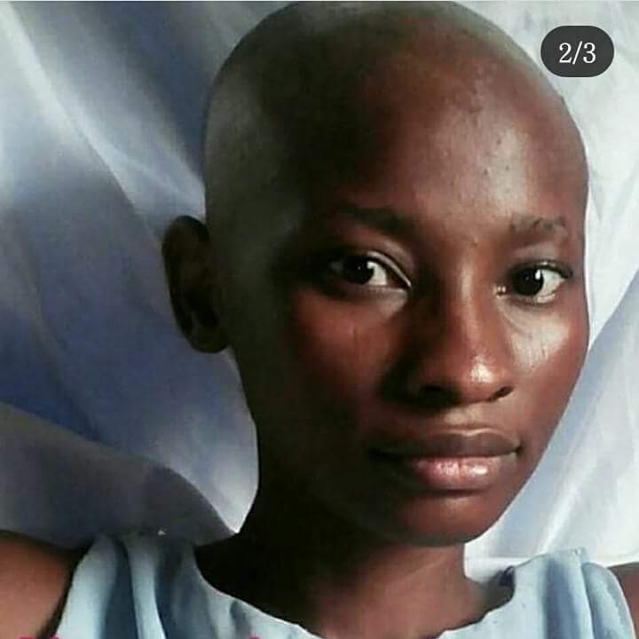 omidan_mayus's tweet photo. I went to Bowen Uni with Alex. She’s ever vibrant and active. Sadly, she’s battling cancer at the moment and needs support. She’s already had 2 brain tumor surgeries. Please help. Her account number is GTB 0136808382 Alexander. Kindly help RT https://t.co/P4BLzEgUcW