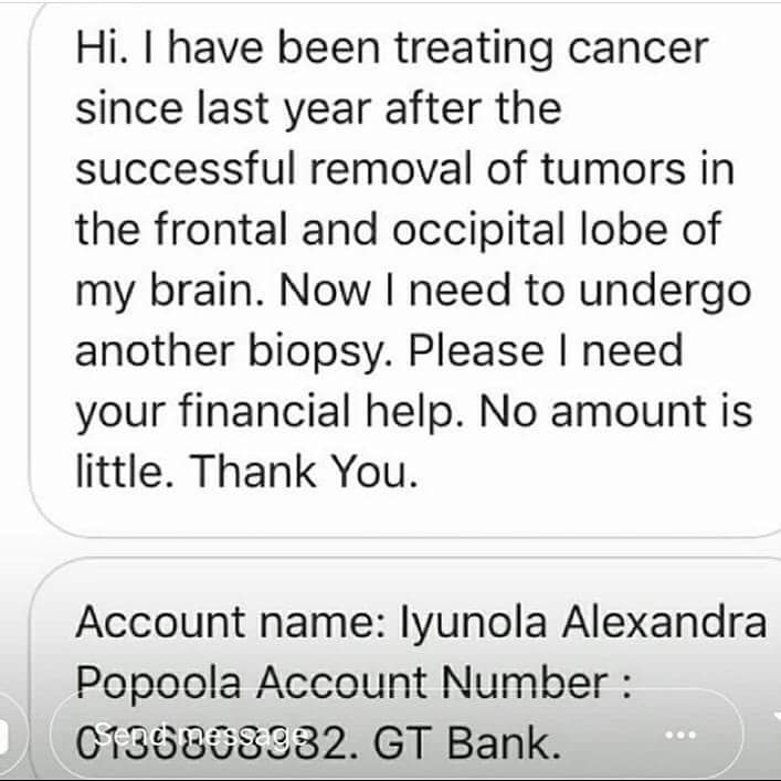 omidan_mayus's tweet photo. I went to Bowen Uni with Alex. She’s ever vibrant and active. Sadly, she’s battling cancer at the moment and needs support. She’s already had 2 brain tumor surgeries. Please help. Her account number is GTB 0136808382 Alexander. Kindly help RT https://t.co/P4BLzEgUcW