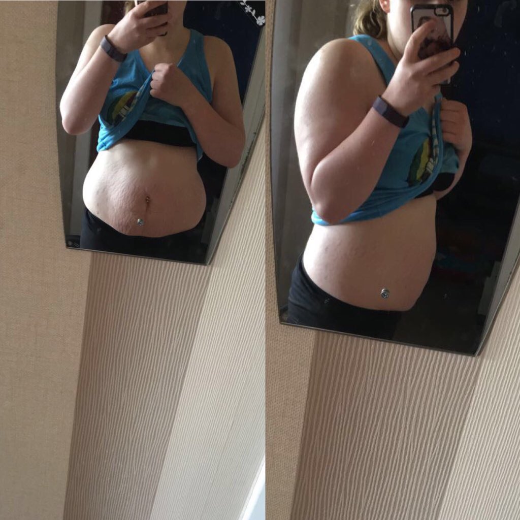 Fitmummylife's tweet photo. First pic was 30th January (fasted), second was on Wednesday (after my lunch)- Amazing what a difference a month can make🙌🏼 https://t.co/j5qIYkwgrM