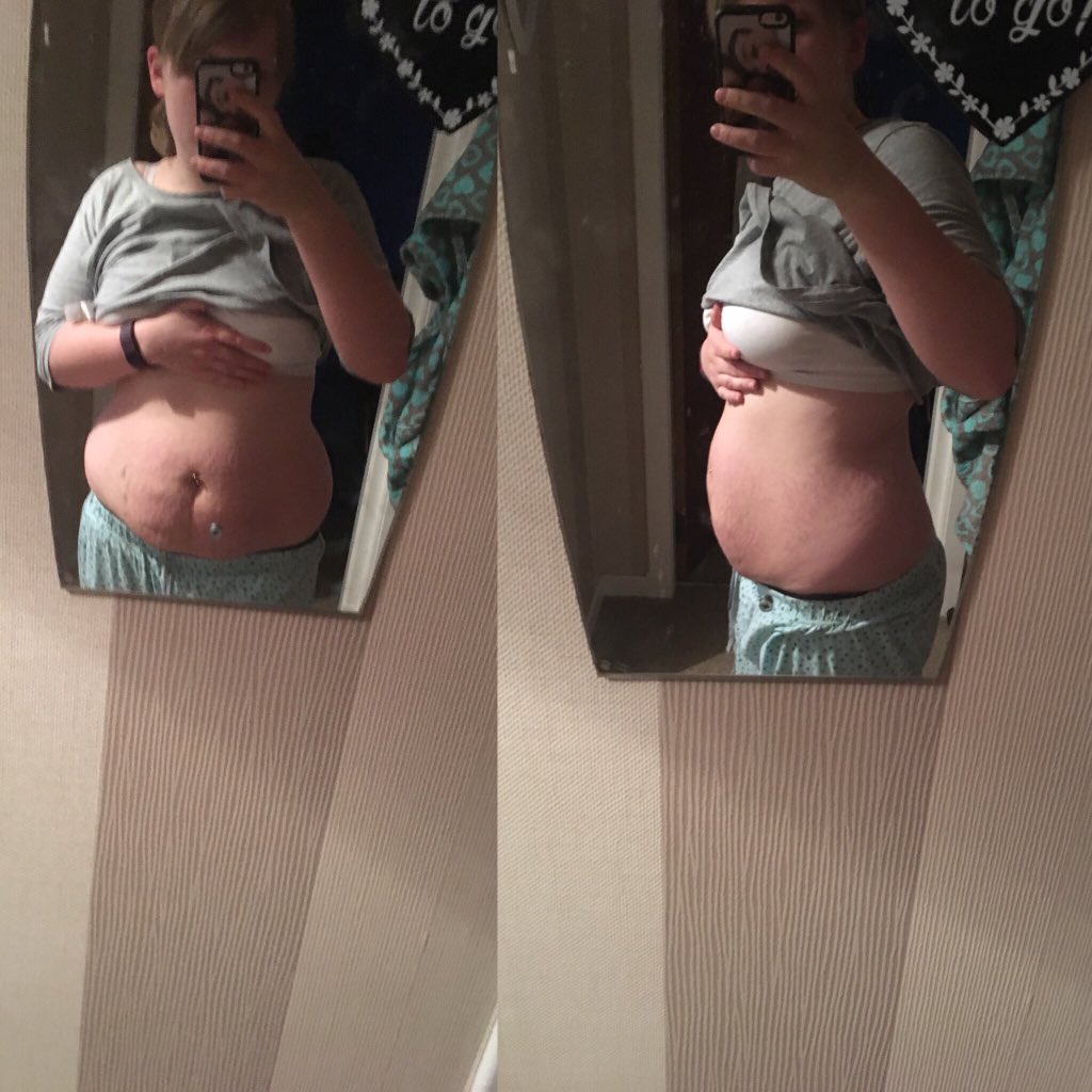 Fitmummylife's tweet photo. First pic was 30th January (fasted), second was on Wednesday (after my lunch)- Amazing what a difference a month can make🙌🏼 https://t.co/j5qIYkwgrM