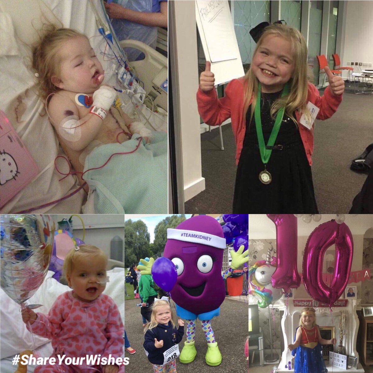 Pl meet 10yr old Ella.She is a wonderful inspiration of hope.To date Ella has had 43 operations &amp;  2 kidney transplants, as well as additional complications. Ellas Mum Karen shares her story in the hope you will talk about #organdonation . goo.gl/1tbvFp