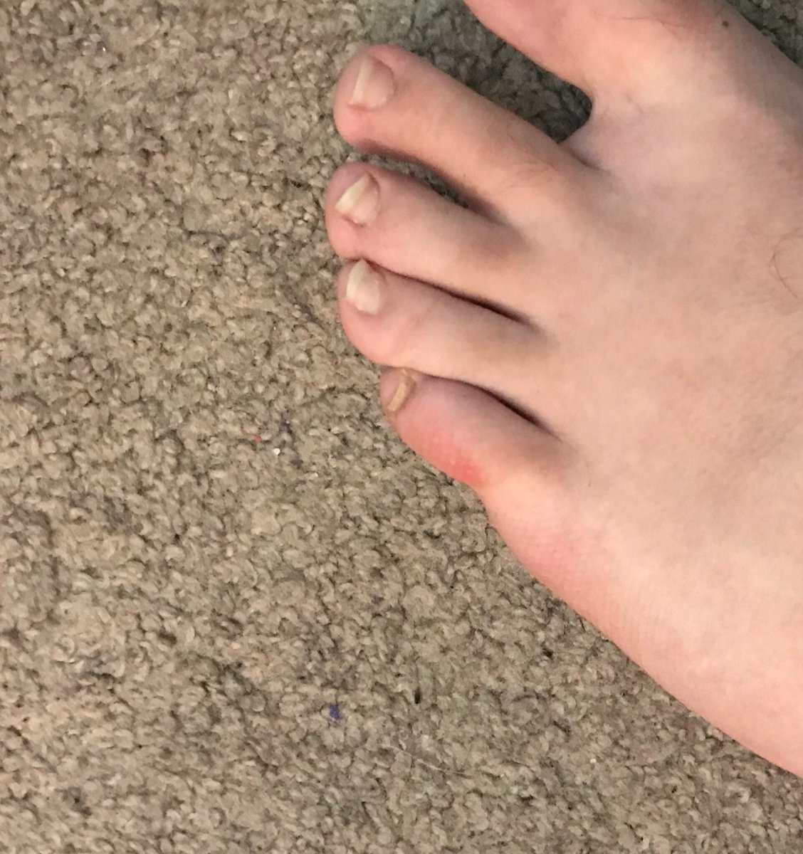 cynical_sadist's tweet image. When you realize your toe hurts so bad from kicking a girl too hard with your sexy #boots! #pummeling #bdsm #fetish #feet #cashmaster