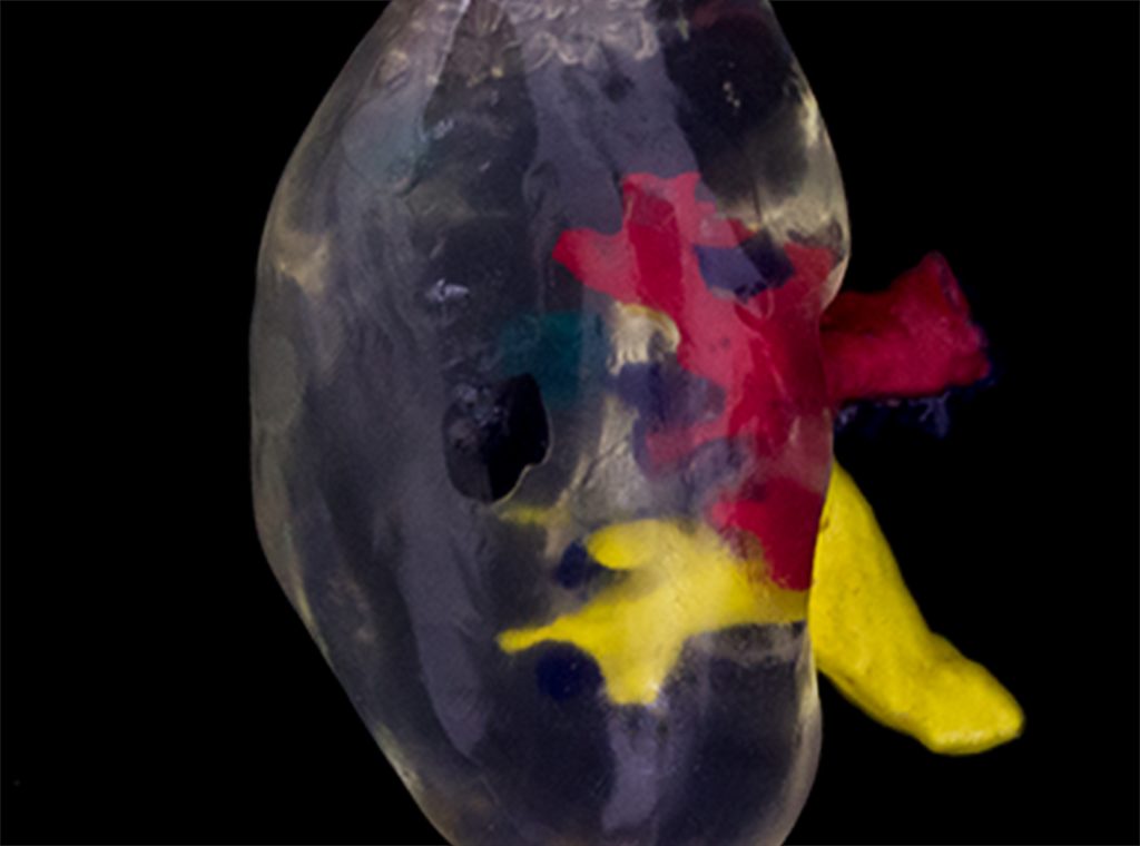 InsightBrief's tweet photo. Kidney transplant using #3Dprinting marks a medical first in Belfast https://t.co/wm7muJi1Es via @3dprintindustry #MedTech #EmergingTecg #3Dprinted #futurism https://t.co/N2FzxyGrZ3