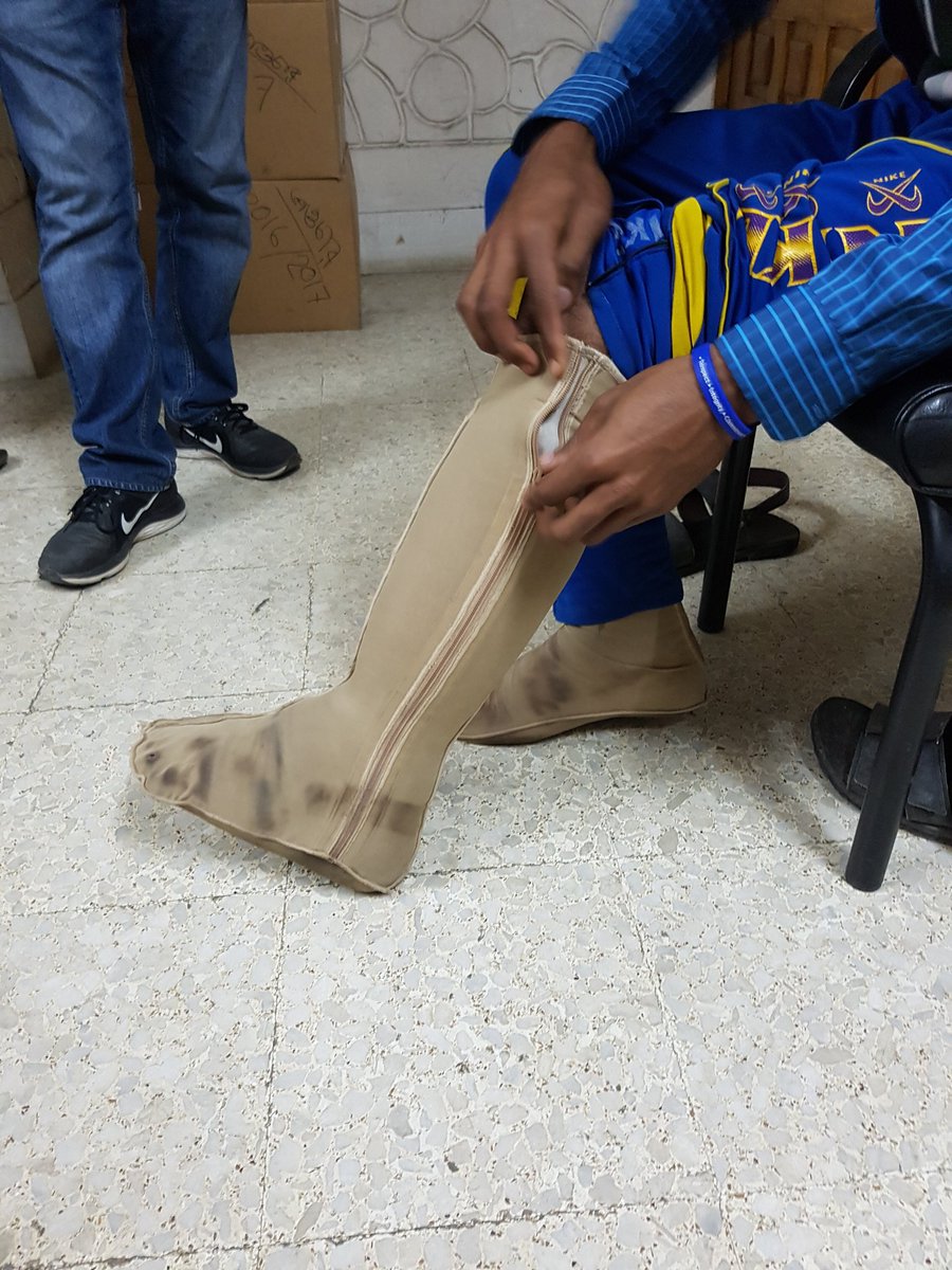 Jan_FRL's tweet photo. Can enhanced #selfcare improve outcomes for advanced stage #lymphoedema? In Bangladesh 20 000 people have lymphoedema. #LymphaticFilariasis program have enormous task to roll out #MorbidityManagement services to all. I hope our study will help those with the most severe disease https://t.co/bpdHyrA8gc