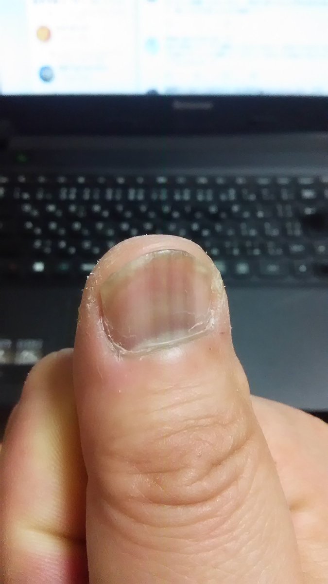 和牛 最近 前より爪の茶色い線が幅広くなってきた 老化現象が進んだと言うことか もう若くないんだなと改めて実感した