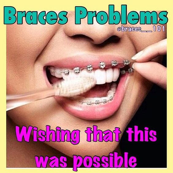 #bracesproblems #braces #teeth #dentist #dental #orthodontist #orthodontics #dentaljokes
