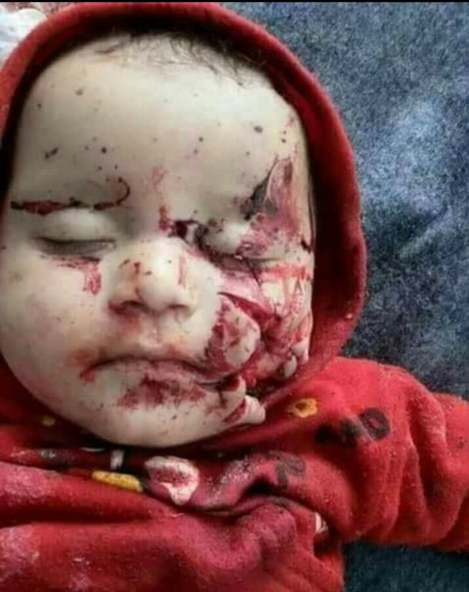 i_rakeshj's tweet photo. हे राम ।। 
#Syrianchildren #SyriaCrisis  #Syriableeding #HumanRightsDiedlnSyria #Syria #SyriaWar #StopSyriaCivilWar #stopSyriawar https://t.co/31pNrQYBfb