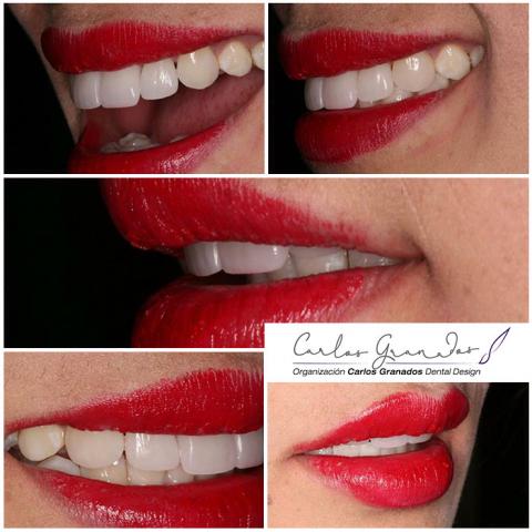 PMeditours's tweet photo. Excellent job!! #DentalDesign
https://t.co/yw92YxriR6 https://t.co/XiEPksqYzV