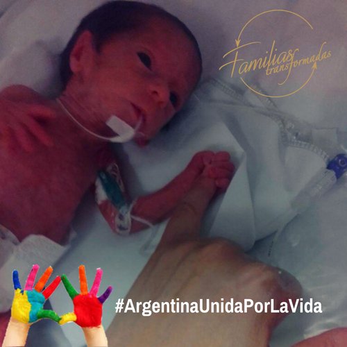 VOY A HABLAR DE LO QUE HE VISTO...... #ArgentinaUnidaPorLaVida
Soy PEDIATRA, y desde el año 2009 trabajo en un servicio de Pediatría y Neonatología. He visto nacer muchos bebes desde entonces, decenas de buenos recuerdos cuando se... Más en goo.gl/f3Ln5u