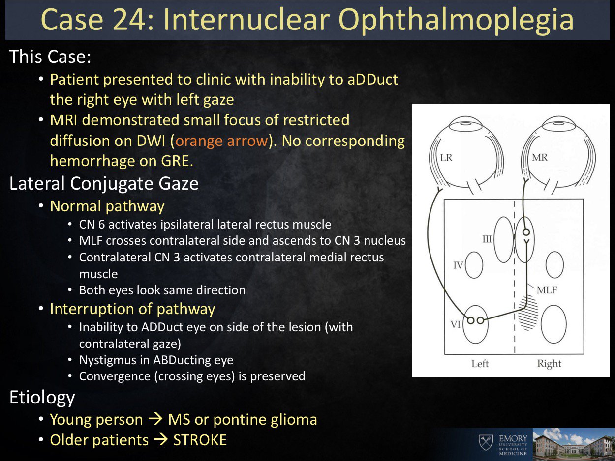 Ryan Peterson 🇸🇪 on Twitter "ANSWER Internuclear