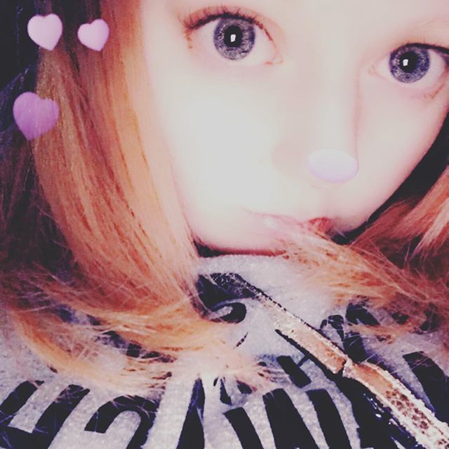 pawzchronicillz's tweet photo. Forever having weird//giant eyes👀 #genetictraitsareweird #EDSprobs #thankssnap #neverlooksnatural 🙄 https://t.co/tIveokzrjQ https://t.co/vQ9g0IBbHO
