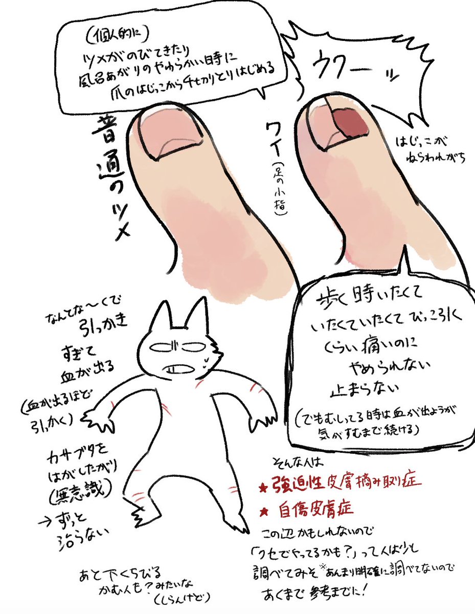 烏海 V Tvittere ほぼちょい調べたレベルの情報なんですが 無自覚に爪を剥がしやすい人 引っ掻き癖のある人 下唇の皮を剥がす人は癖じゃなくて ただの病気かも って感じだったので もし心当たりのある人は参考までに 烏海 V Tvittere ほぼちょい調べたレベルの情報なんですが 無自覚に爪を剥がしやすい人 引っ掻き癖のある人 下唇の皮を剥がす人は癖じゃなくて ただの病気かも って感じだったので もし心当たりのある人は参考までに
