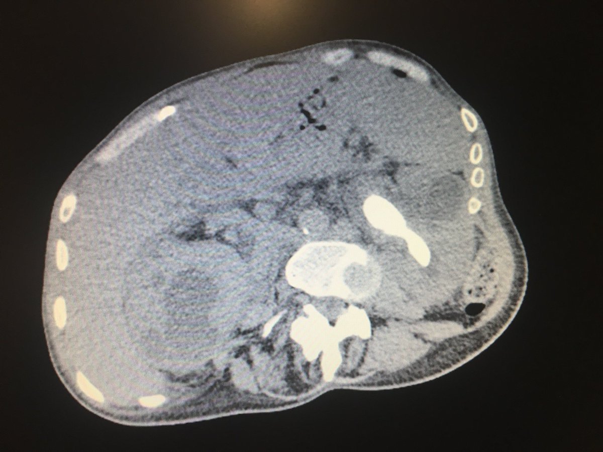 Oriol Angerri tweet media