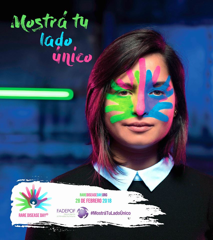 KetchumARG's tweet photo. ¡#MostráTuLadoÚnico en el Día Mundial de las Enfermedades Poco Frecuentes!  

Subí una selfie con la cara pintada mostrando ese lado que te hace único, o enteráte de las distintas formas en que podés participar de la campaña de @FADEPOF haciendo click acá: https://t.co/kTco2gc5VK https://t.co/s9DE2STtRq