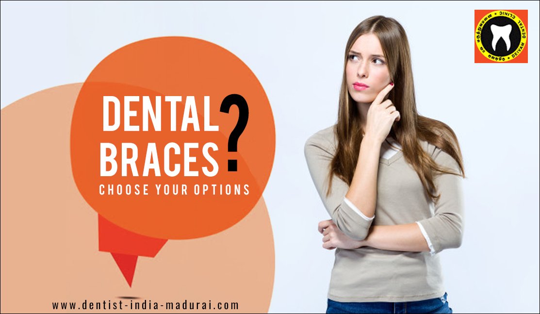 Dental braces are used in orthodontics that aligns and straighten teeth.
Make an appointment: dentist-india-madurai.com/book-appointme…
For more details:dentist-india-madurai.com/metallic-denta…
#Teeth_Braces #Teeth_Alignment
#Tamil_Nadu #India