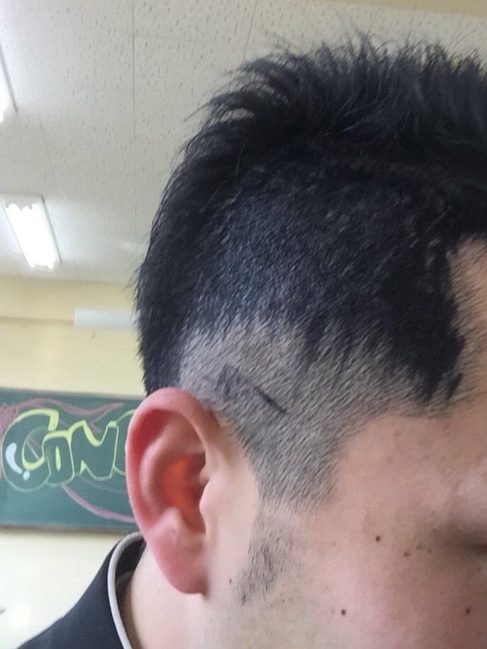 3年間の最後に、頭髪が奇抜と注意された友人の「おかんが"塗れ!"って言うから手伝って」という指示に従ったことで大変充実した思い出ができました 