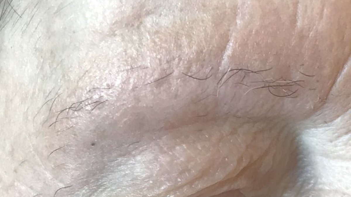Desaze's tweet photo. ¿POR QUÉ SE PUEDEN PERDER LAS CEJAS? 🤨 Existen diferentes motivos por los que se pueden perder las cejas. Todos hay que tenerlos en cuenta para llegar a un diagnóstico correcto ✅ y poner solución a este problema.👍🏻 Toda la información en el blog 🔜 https://t.co/CV4vk9a7WB https://t.co/BCvSdUyFFr