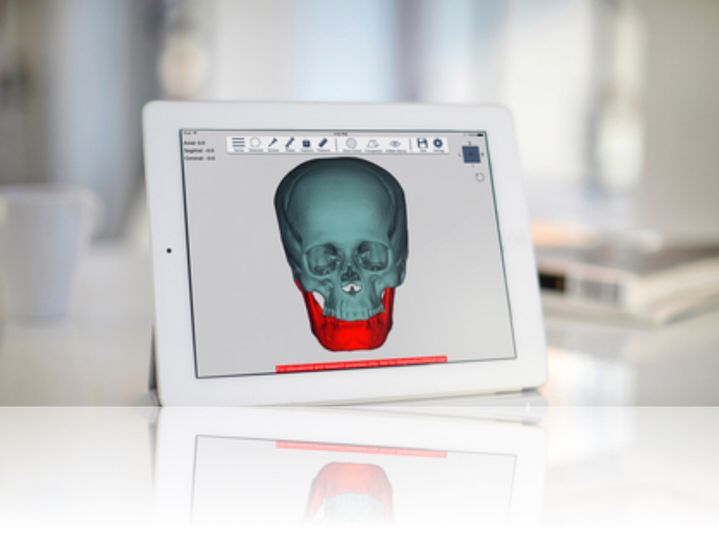 Take the efficiencies of #3Dprinting right to your doctors with a #mobileapp #pointofcare #digitalhealth #InterfaceIsEverything #medtech #healthIT #medical3Dprinting #patientexperience #patientspecific #personalizedmedicine #HIMSS2018 #HIMSS18 #HIMSS