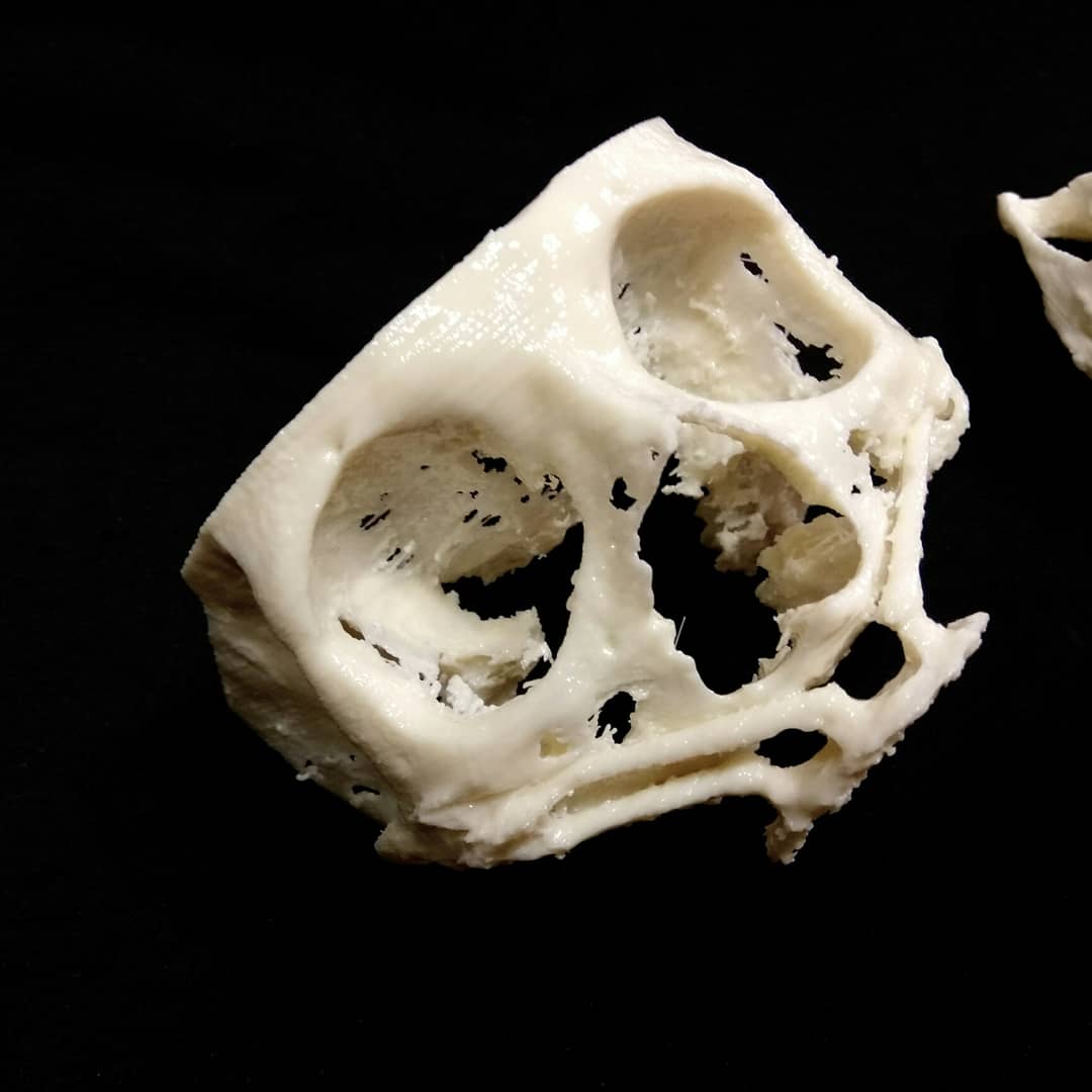 MM3D_'s tweet photo. #impresión3d de #cráneo parte frontal. #zigomatico #3DPrinting #3dmodel #bones #medicalmodel3d #medicaldevice #traumatologia #maxilofacial #maxilofacialsurgery #surgeryplanning https://t.co/kr1EYWQ3mR