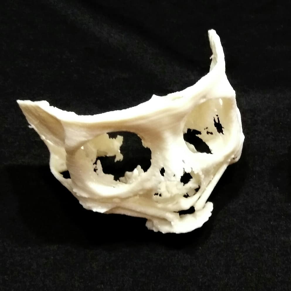 MM3D_'s tweet photo. #impresión3d de #cráneo parte frontal. #zigomatico #3DPrinting #3dmodel #bones #medicalmodel3d #medicaldevice #traumatologia #maxilofacial #maxilofacialsurgery #surgeryplanning https://t.co/kr1EYWQ3mR