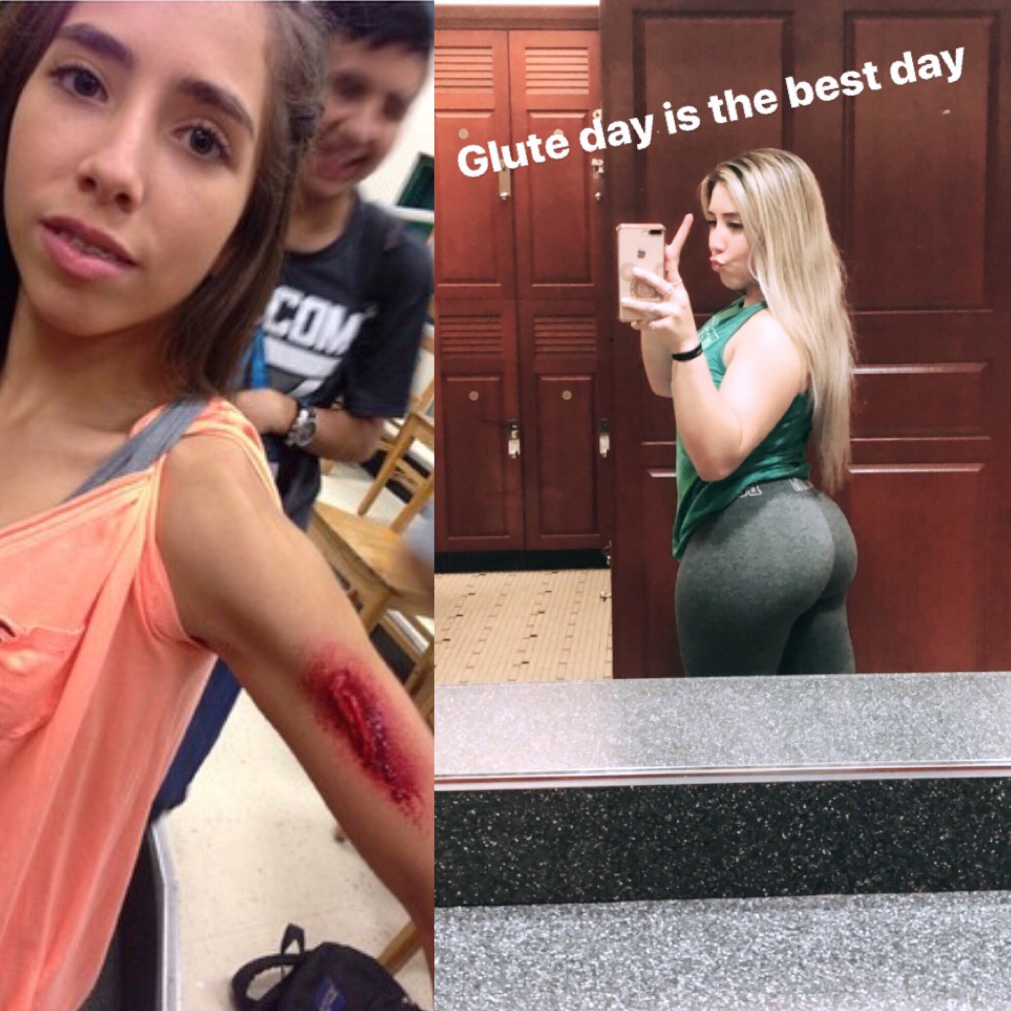 anorexic ass  / X
