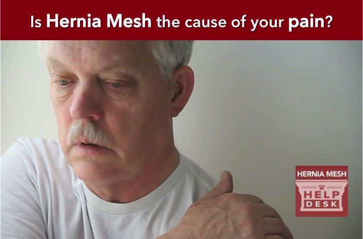 HerniaMeshHelp's tweet image. Is hernia mesh causing your #pain? Learn the complications associated with #herniamesh impactlaw.com/defective-medi…