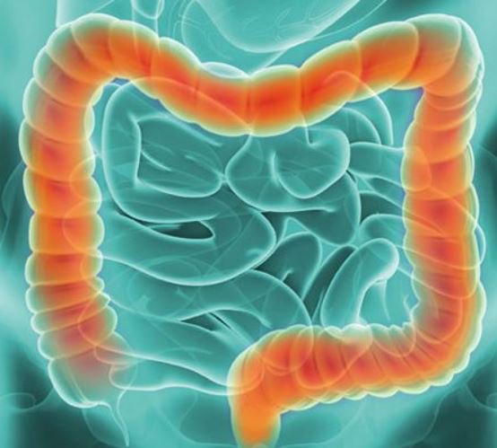 We are excited to support Colorectal Cancer Awareness Month! The research we do is instrumental in improving the survival and quality of treatment for #colorectalcancer patients. #GIcancer