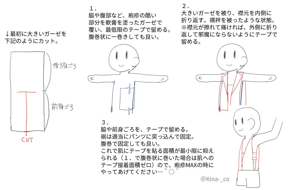 きなこ Oㅅo Twitterren 帯状疱疹発症時は軟膏を塗ってガーゼで抑えるんだけど テープを肌に貼る事自体が刺激になるのでこういう巻き方を教えて貰った 着付けの仕事をしていた親戚発案 お医者さんにも感心された巻き方