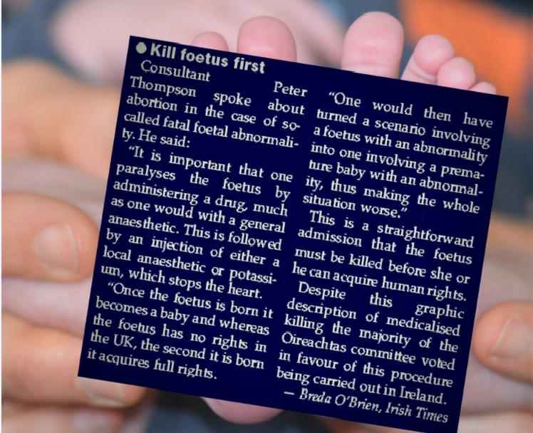 AliveNewsPaper's tweet image. #TrisomyAwarenessMonth #edwardsyndrome #trisomy18 #everylifecounts @EveryLifeCount testimony of consultant on abortion for baby with long-term illness #fatal4 baby