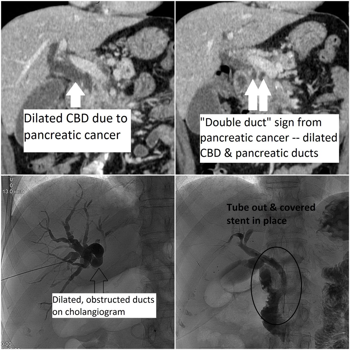 irad program irad program