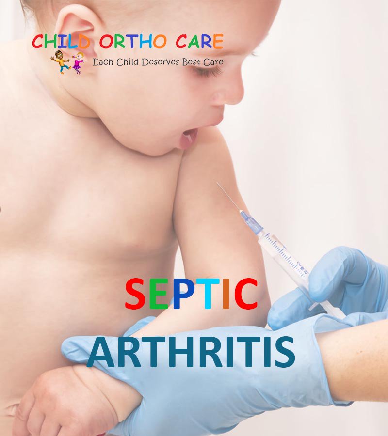 plabondd's tweet photo. Child Orthopedic Specialist Doctor &amp; Consultant.
https://t.co/bZCy9BHFcF
#childorthocare #septicarthritis #childorthopedic https://t.co/khxvZ1Zrys