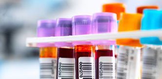 TESTITtrial's tweet photo. TEST-IT Sites: By now all study samples will have been collected following yesterday's deadline. Remember there still remains a 72 hour window in which to gain consent for these patients (ENG/NI). Great to see large numbers collected on our last day. Fantastic effort from sites! https://t.co/8UXUUAhFs3