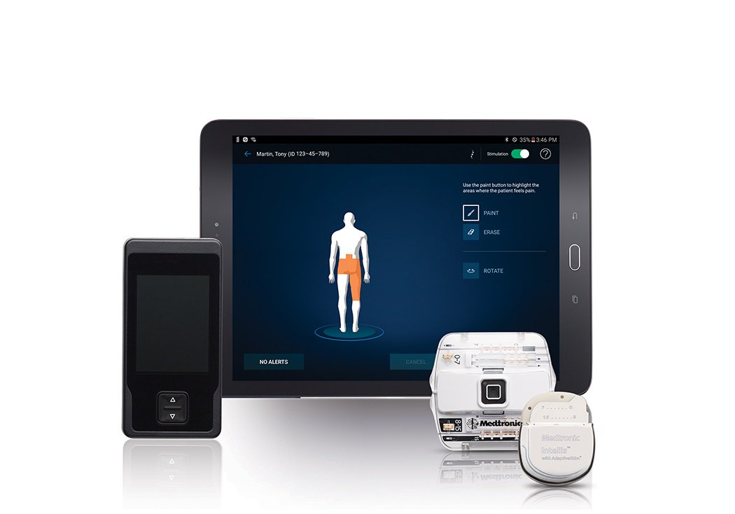 Adnkronos's tweet photo. Arriva il #pacemaker anti-#dolore #intellis
https://t.co/NhPyDmJZS4 https://t.co/kuiqQgJfap
