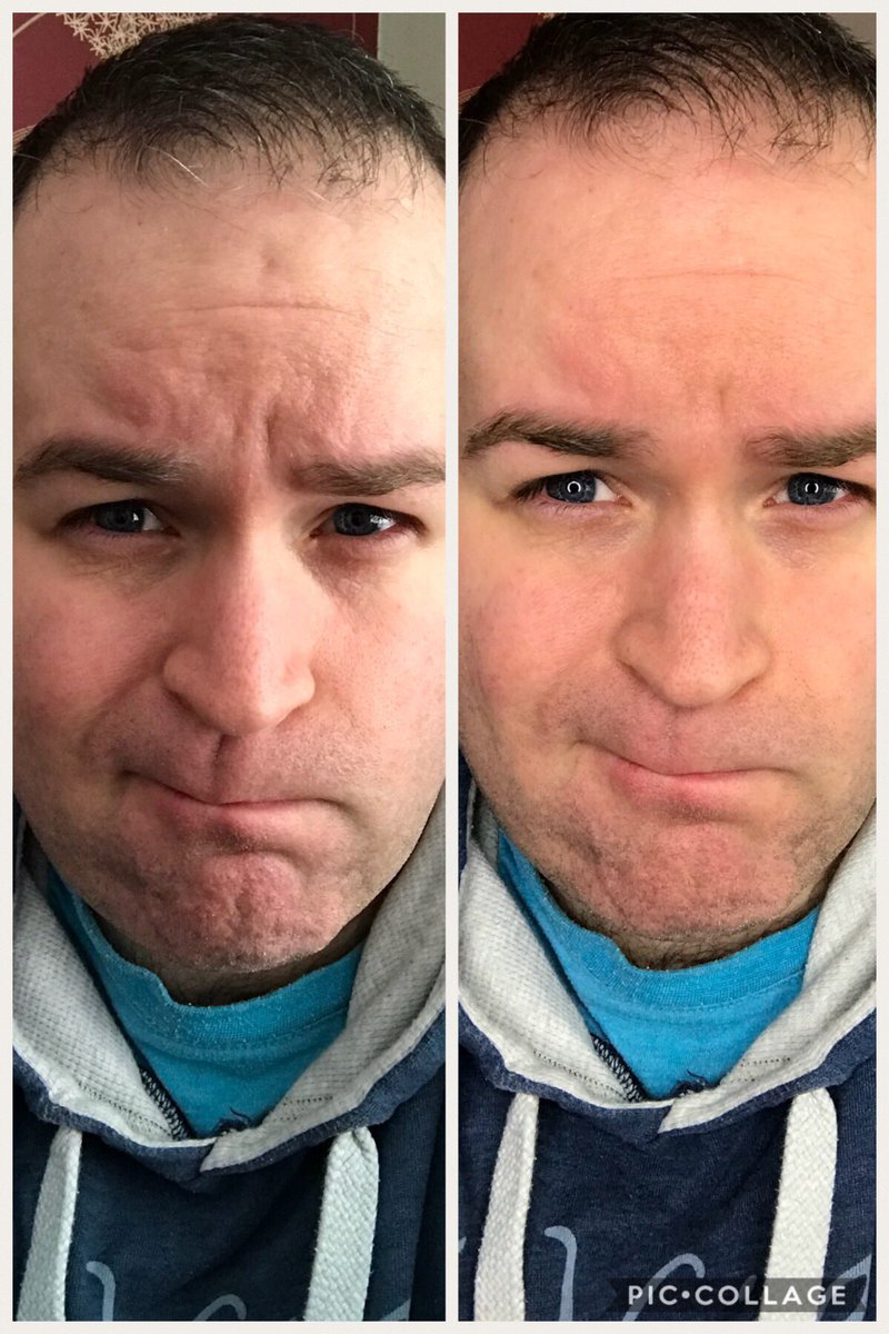 Love4MusicUK's tweet photo. Testing out my new Ring Light. What a difference! It’s like an IRL filter. #nofilter #neewerringlight #neewerlighting #neewerlight #youtubers #ringlight https://t.co/cP3xwnLjuk