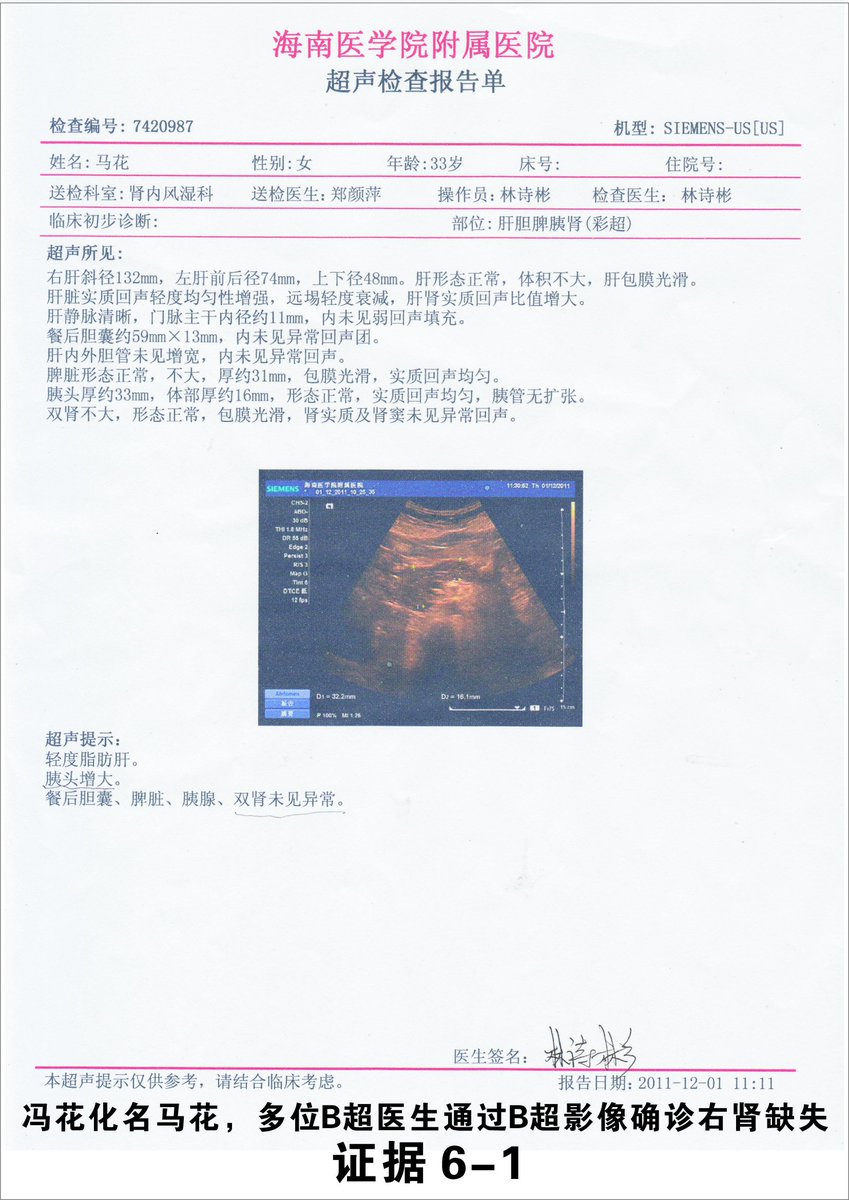 ট ইট র 网络搜索 海南冯花 抗日战争八年都结束了 我们维权第九年 看不到一点希望 中国百姓最缺人权 民主 自由和法制 下列资料是冯花 及其家属质疑医院故意治假病残害病患 头痛入院被伪造脑动脉瘤毁神经系统疑盗骨髓肾肝卵巢 相关证据 一共1 26页 6 4 ট ইট র 网络搜索 海南冯花 抗日战争八年都结束了 我们维权第九年 看不到一点希望 中国百姓最缺人权 民主 自由和法制 下列资料是冯花 及其家属质疑医院故意治假病残害病患 头痛入院被伪造脑动脉瘤毁神经系统疑盗骨髓肾肝卵巢 相关证据 一共1 26页 6 4