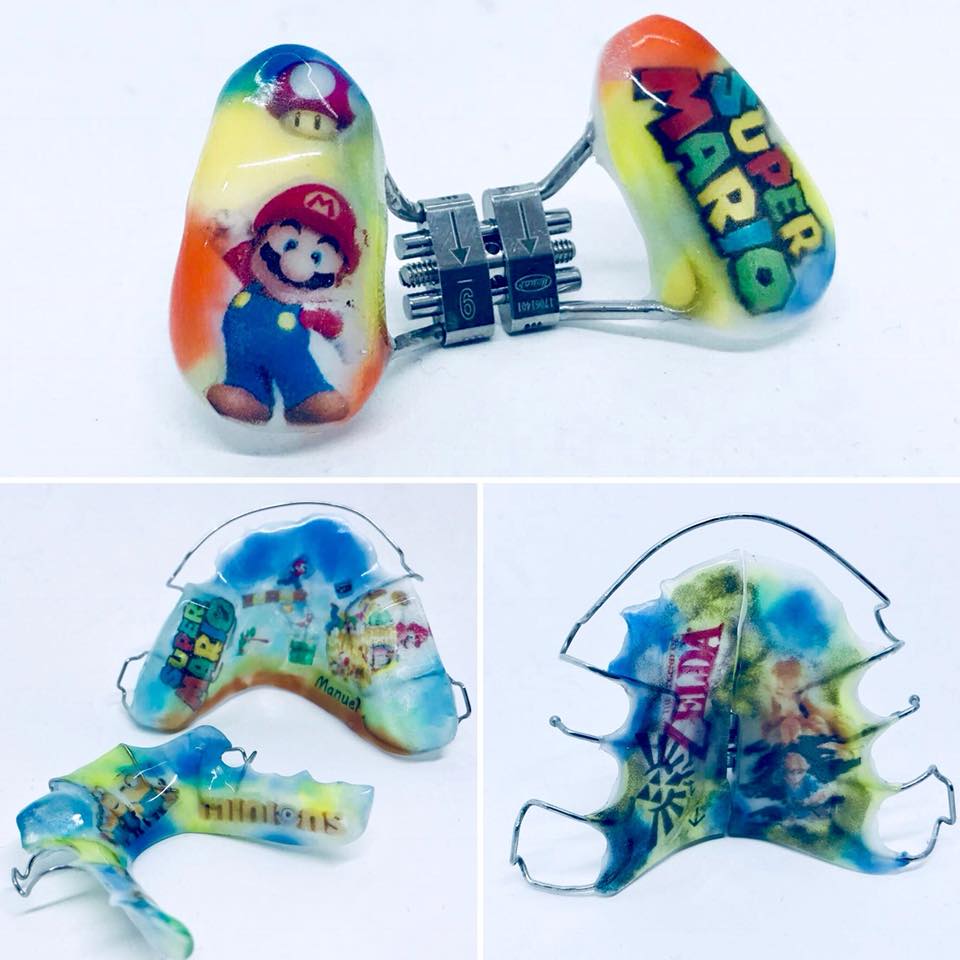 CliDentZafrilla's tweet photo. #PersonalizatuOrtodoncia 😍👉¿Quién dijo que la #ortodoncia fuera aburrida?👈 En @CliDentZafrilla personalizamos los #aparatos de los peques de la casa😃 ➡Os dejamos con estos modelos que han realizado nuestros compañeros de @OrthoLab_es con Súper Mario, Zelda y los Minions 🤩 https://t.co/3LdSuNiXaR