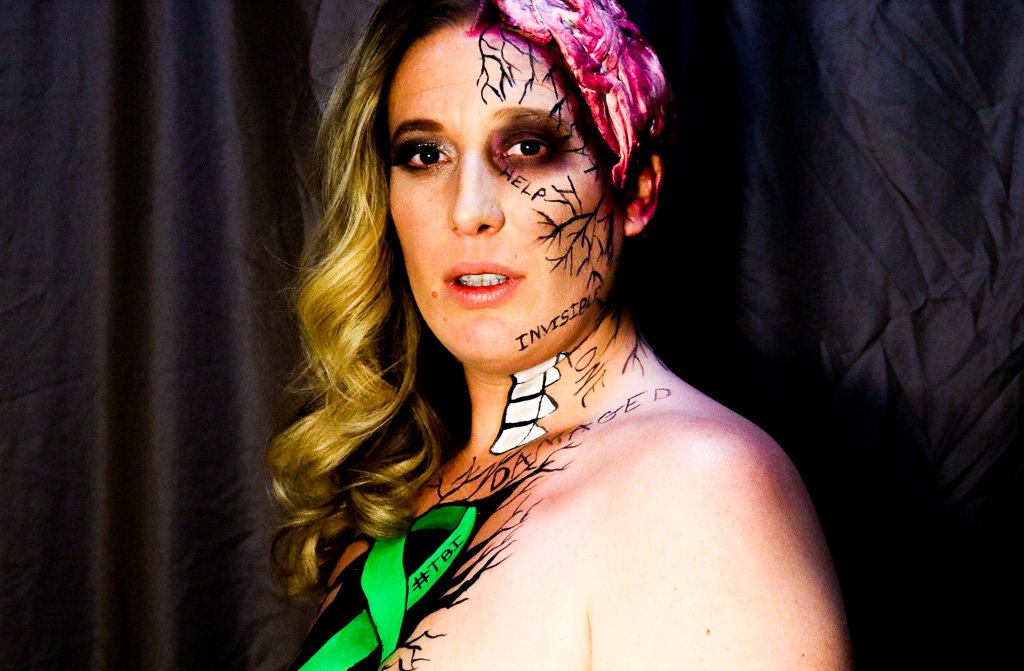 mybraininjury's tweet photo. This year for #BIAM I teamed up with professional makeup artist Adele Campbell to make the "invisible" parts of my #TBI VISIBLE. Check out my blog for the #ChangeYourMind campaign. https://t.co/G3v2Nkfvf2 https://t.co/UJSJwLwlik