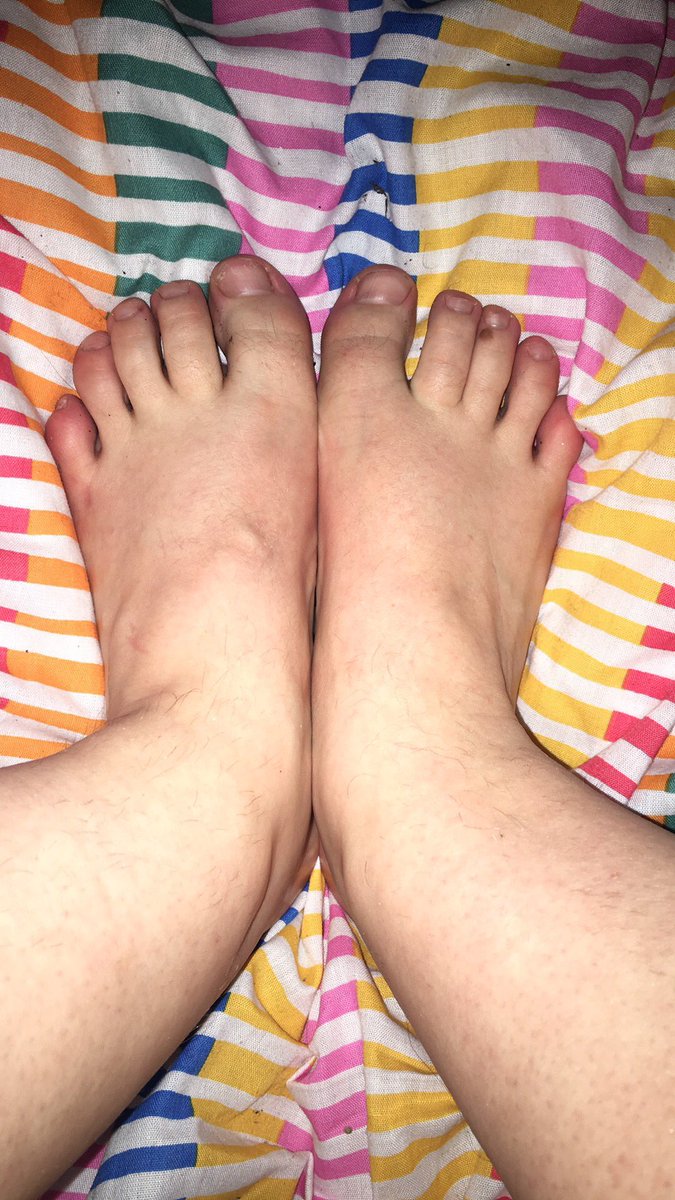 internetqueen69's tweet photo. come watch me rub my sexy soles, selling a 10 minute Uk size 2 foot massage video for just £10 DM me or message on kik @ internetprincess666

#soles #sexysoles #smallfeet #tinyfeet #footfetish #feet #feetkink @rtdumb @RToinky @IRporn_fan @sanco4033 @RT4FD @rtserf @RTPork https://t.co/FjJC5LKT3g
