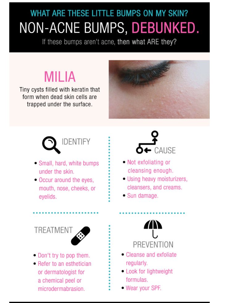 moisturizer for tiny bumps