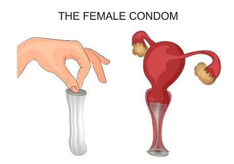 And because women have the right to their own bodies, WE NEED FEMALE CONDOMS IN THE PHILIPPINES TOO. 